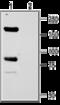 Acid Sensing Ion Channel Subunit 1 antibody, GTX54804, GeneTex, Western Blot image 