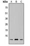 SPT4 Homolog, DSIF Elongation Factor Subunit antibody, GTX55283, GeneTex, Western Blot image 