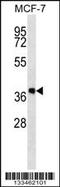 Dehydrogenase/Reductase 7B antibody, 57-001, ProSci, Western Blot image 