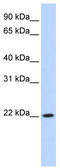 Deleted In Primary Ciliary Dyskinesia Homolog (Mouse) antibody, TA333820, Origene, Western Blot image 