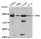 Transglutaminase 2 antibody, A0981, ABclonal Technology, Western Blot image 