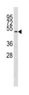 Tubulin Delta 1 antibody, abx034721, Abbexa, Western Blot image 