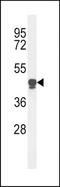 Platelet-activating factor acetylhydrolase antibody, TA325117, Origene, Western Blot image 