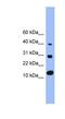 Bone Morphogenetic Protein 7 antibody, NBP1-69126, Novus Biologicals, Western Blot image 