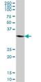 Ankyrin repeat domain-containing protein 1 antibody, H00027063-B02P, Novus Biologicals, Western Blot image 