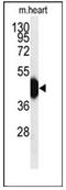 Hemojuvelin BMP Co-Receptor antibody, AP52036PU-N, Origene, Western Blot image 