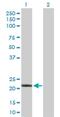 Interferon Alpha 10 antibody, H00003446-D01P, Novus Biologicals, Western Blot image 