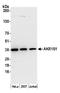 Aldose reductase antibody, A305-312A, Bethyl Labs, Western Blot image 
