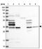 STIP1 Homology And U-Box Containing Protein 1 antibody, NBP2-47510, Novus Biologicals, Western Blot image 