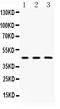 Galactosidase Alpha antibody, A01135, Boster Biological Technology, Western Blot image 