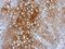 Bromodomain Containing 9 antibody, NBP2-15614, Novus Biologicals, Immunohistochemistry frozen image 