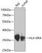 Major Histocompatibility Complex, Class II, DR Alpha antibody, GTX55661, GeneTex, Western Blot image 
