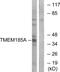 Transmembrane Protein 185A antibody, PA5-39707, Invitrogen Antibodies, Western Blot image 