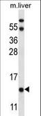 Ubiquinol-Cytochrome C Reductase Binding Protein antibody, LS-C160452, Lifespan Biosciences, Western Blot image 