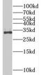 Basic, Immunoglobulin-Like Variable Motif Containing antibody, FNab00902, FineTest, Western Blot image 