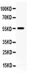 Tissue Factor Pathway Inhibitor antibody, PA5-80113, Invitrogen Antibodies, Western Blot image 