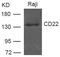CD22 Molecule antibody, GTX50795, GeneTex, Western Blot image 