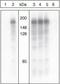 Insulin Receptor Substrate 1 antibody, GTX24865, GeneTex, Western Blot image 