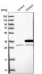 Proteasome Assembly Chaperone 2 antibody, PA5-59610, Invitrogen Antibodies, Western Blot image 
