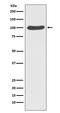 Catenin Alpha 1 antibody, M01617, Boster Biological Technology, Western Blot image 