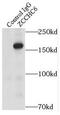 Terminal uridylyltransferase 7 antibody, FNab09611, FineTest, Immunoprecipitation image 