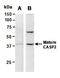 Cullin 3 antibody, orb66953, Biorbyt, Western Blot image 