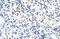 DEAD-Box Helicase 47 antibody, NBP1-57295, Novus Biologicals, Immunohistochemistry paraffin image 