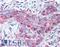 Matrix Metallopeptidase 13 antibody, LS-A1553, Lifespan Biosciences, Immunohistochemistry paraffin image 