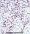 NCK Adaptor Protein 1 antibody, abx027563, Abbexa, Immunohistochemistry paraffin image 