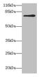 Methylenetetrahydrofolate reductase antibody, CSB-PA015158LA01HU, Cusabio, Western Blot image 