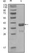 ABL Proto-Oncogene 1, Non-Receptor Tyrosine Kinase antibody, M00133, Boster Biological Technology, Western Blot image 