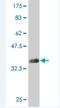 ATPase Phospholipid Transporting 11B (Putative) antibody, H00023200-M01, Novus Biologicals, Western Blot image 