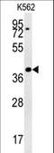 Protein DGCR14 antibody, LS-C167379, Lifespan Biosciences, Western Blot image 