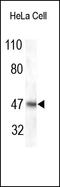 E3 ubiquitin-protein ligase TRIM13 antibody, 251946, Abbiotec, Western Blot image 