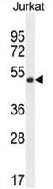 Smad Nuclear Interacting Protein 1 antibody, AP53961PU-N, Origene, Western Blot image 