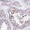 SH3KBP1 Binding Protein 1 antibody, NBP1-87252, Novus Biologicals, Immunohistochemistry frozen image 