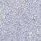 Cyclin Dependent Kinase 1 antibody, NBP1-85729, Novus Biologicals, Immunohistochemistry paraffin image 