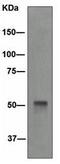 Keratin 14 antibody, GTX62683, GeneTex, Western Blot image 