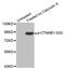 Catenin Beta 1 antibody, STJ22083, St John