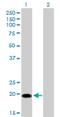 Centrin 1 antibody, H00001068-M01, Novus Biologicals, Western Blot image 