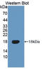 TNF Receptor Superfamily Member 19 antibody, LS-C374772, Lifespan Biosciences, Western Blot image 