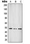 Suppressor Of Variegation 3-9 Homolog 2 antibody, LS-C353562, Lifespan Biosciences, Western Blot image 