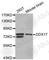 DEAD-Box Helicase 17 antibody, A5957, ABclonal Technology, Western Blot image 