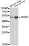 Aldehyde Dehydrogenase 2 Family Member antibody, STJ22581, St John