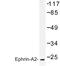 Ephrin A2 antibody, AP06639PU-N, Origene, Western Blot image 