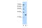 Forkhead Box R2 antibody, 29-806, ProSci, Western Blot image 