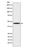 Serpin Family F Member 1 antibody, M02034, Boster Biological Technology, Western Blot image 