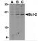 BCL2 antibody, MBS150199, MyBioSource, Western Blot image 