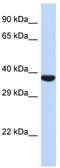Transmembrane Protein With Metallophosphoesterase Domain antibody, TA335897, Origene, Western Blot image 