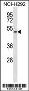 Phosphatidylinositol Glycan Anchor Biosynthesis Class T antibody, 58-317, ProSci, Western Blot image 